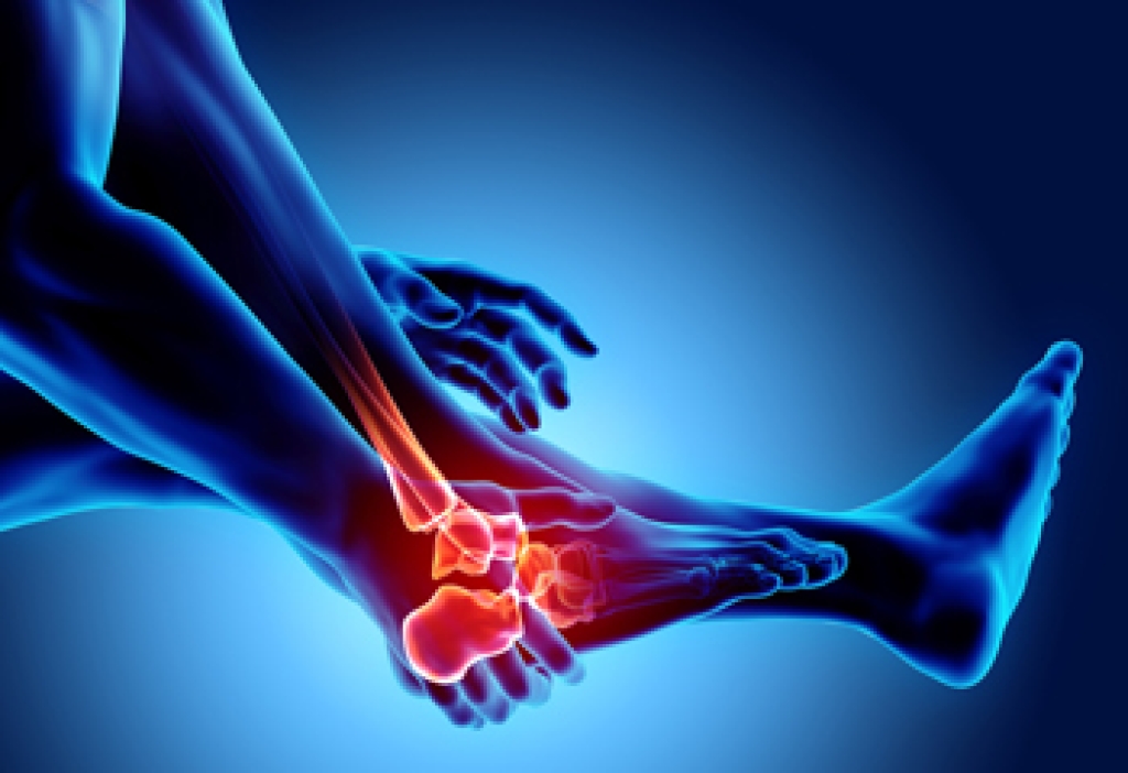 Chiropractic Care for Arthritis Symptoms